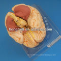 ISO Deluxe Brain Anatomical model,brain anatomy